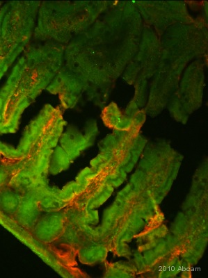 IHC-Fr image of human duodenum section stained with ab66048. The sections were incubated in 10% normal donkey serum in 0.1% PBS- and 0.3x triton100 for 1h to permeabilise the cells and to block non-specific protein-protein interactions. The sections were then incubated with the antibody ab66048, 1µg/ml) and Anti-Actin overnight at +4°C. The secondary antibody was Alexa Alexa Fluor® 488 goat anti-rabbit IgG (H+L) and Fluor®568 donkey anti-mouse IgG (H+L) used at a 1/1000 dilution for 1h. DAPI was used to stain the cell nuclei (blue) at a concentration of 1.43µM. dCytb stained apical site of duodenum and actin stained muscles and blood vessels.See Abreview