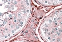 ab28758 at 2.5 µg/ml staining Cytochrome b reductase 1 in Human testis by Immunohistochemistry (Formalin/PFA-fixed paraffin-embedded sections). Steamed antigen retrieval with citrate buffer pH 6, AP-staining.