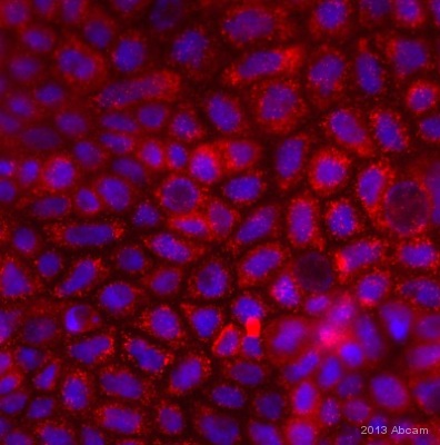 ICC/IF image of Cytochrome b reductase staining on Caco 2 cells using ab28758 (1:200). The cells were fixed using 4% PFA and permeabilized using 0.1% TritonX in 0.1% PBS. The cells were blocked by incubating 10% donkey serum for 1 hour at 24°C. ab28758 (1:200) was incubated for 4 hours at 24°C. the secondary antibody used was donkey polyclonal to Goat IgG conjugated to Alexa Fluor 568.See Abreview