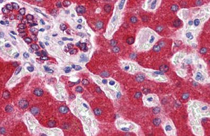 ab129335 at 5 µg/ml staining Cytochrome b5 in Formalin-Fixed, Paraffin-Embedded Human liver tissue by immunohistochemistry.