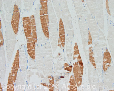 IHC image of Cytochrome C staining in human skeletal muscle formalin fixed paraffin embedded tissue section, performed on a Leica BondTM system using the standard protocol F. The section was pre-treated using heat mediated antigen retrieval with sodium citrate buffer (pH6, epitope retrieval solution 1) for 20 mins. The section was then incubated with ab50050, 5µg/ml, for 15 mins at room temperature and detected using an HRP conjugated compact polymer system. DAB was used as the chromogen. The section was then counterstained with haematoxylin and mounted with DPX. For other IHC staining systems (automated and non-automated) customers should optimize variable parameters such as antigen retrieval conditions, primary antibody concentration and antibody incubation times.