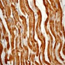 ab76237, at a 1/100 dilution, staining human Cytochrome C in heart muscle by Immunohistochemistry, Formalin/PFA-fixed paraffin-embedded tissue.