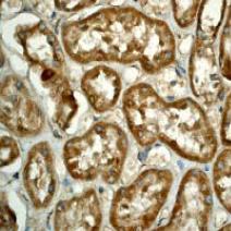 ab76237, at a 1/100 dilution, staining human Cytochrome C in kidney by Immunohistochemistry Formalin/PFA-fixed paraffin-embedded tissue.