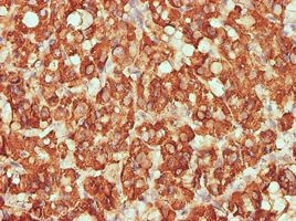 Cytochrome C Oxidase subunit VIc antibody (ab54577) used in immunohistochemistry at 5ug/ml on formalin fixed and paraffin embedded human thyroid nodular goiter tissue.