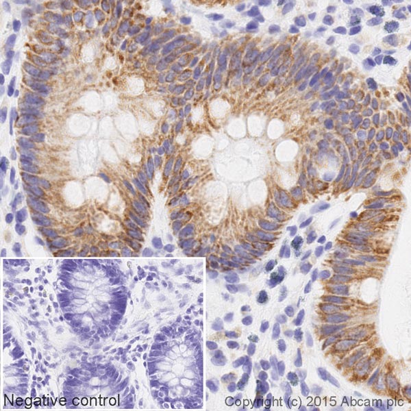 IHC image of Cytochrome C Oxidase subunit VIc staining in a section of formalin-fixed paraffin-embedded normal human colon tissue*, performed on a Leica BOND. The section was pre-treated using heat mediated antigen retrieval with sodium citrate buffer (pH6, epitope retrieval solution 1) for 20mins. The section was then incubated with ab198402 at 1/100 dilution, for 15 mins at room temperature. DAB was used as the chromogen. The section was then counterstained with haematoxylin and mounted with DPX. The inset negative control image is taken from an identical assay without primary antibody.For other IHC staining systems (automated and non-automated) customers should optimize variable parameters such as antigen retrieval conditions, primary antibody concentration and antibody incubation times.*Tissue obtained from the Human Research Tissue Bank, supported by the NIHR Cambridge Biomedical Research Centre