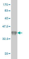 Western blot against tagged recombinant protein immunogen using ab57412 Cytochrome P450 26B antibody at 1ug/ml.