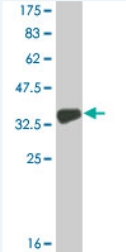 Anti-COL9A3 antibody (ab76507) at 1/500 dilution + immunogen at 0.2 µgSecondaryGoat Anti-Mouse IgG (H&L)-HRP Conjugate at 1/5000 dilution