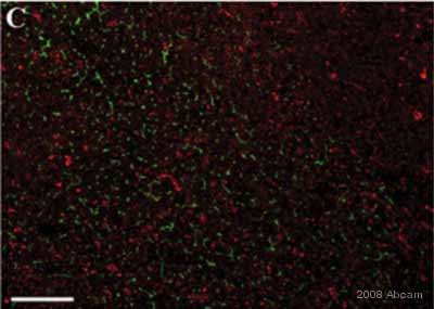 ab28146 staining cells of rat liver sections by IHC-Fr.  Cells were fixed in acetone and blocked with 1% BSA for 5 minutes at 25°C prior to incubating with ab28146 diluted 1/300 for 30 minutes at 25°C.  An Alexa Fluor® 594 conjugated goat anti-rabbit antibody was used as the secondary.Double IF labeling with CYP2E1 (Red) and dipeptidyl peptidase IV (Green)See Abreview
