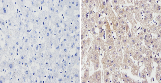 ab3573 labelling Cytochrome P450 4A in the cytoplasm and membrane of Human liver tissue (right) compared with a negative control in the absence of primary antibody (left). To expose target proteins, antigen retrieval method was performed using 10mM sodium citrate (pH 6.0) microwaved for 8-15 min. Tissues were blocked in 3% H2O2-methanol for 15 min at room temperature. Tissue sections were incubated with the primary antibody (1:200 in 3% BSA-PBS) overnight at 4°C. A HRP-conjugated anti-rabbit was used as the secondary antibody, followed by colorimetric detection using a DAB kit. Tissues were counterstained with hematoxylin and dehydrated with ethanol and xylene to prep for mounting.