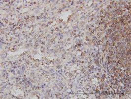 Cytohesin 1 antibody (ab56511) used in immunohistochemistry at 3ug/ml on formalin fixed and paraffin embedded human spleen.