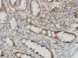 Cytohesin 2 antibody (ab56510) used in immunohistochemistry at 3ug/ml on formalin fixed and paraffin embedded human colon.