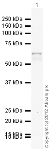 Anti-Cytokeratin 10 antibody (ab111447) at 1 µg/ml + Skin (Human) Tissue Lysate - adult normal tissue (ab30166) at 10 µgSecondaryGoat Anti-Rabbit IgG H&L (HRP) preadsorbed (ab97080) at 1/5000 dilutiondeveloped using the ECL techniquePerformed under reducing conditions.