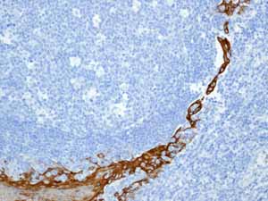 Immunohistochemical analysis of paraffin embedded normal Human tonsil squamous cells tissue using ab133340 showing +ve staining.