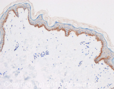 IHC image of Cytokeratin 15 staining in human normal skin formalin fixed paraffin embedded tissue section, performed on a Leica BondTM system using the standard protocol F. The section was pre-treated using heat mediated antigen retrieval with sodium citrate buffer (pH6, epitope retrieval solution 1) for 20 mins. The section was then incubated with ab111448, 5µg/ml, for 15 mins at room temperature and detected using an HRP conjugated compact polymer system. DAB was used as the chromogen. The section was then counterstained with haematoxylin and mounted with DPX. For other IHC staining systems (automated and non-automated) customers should optimize variable parameters such as antigen retrieval conditions, primary antibody concentration and antibody incubation times.
