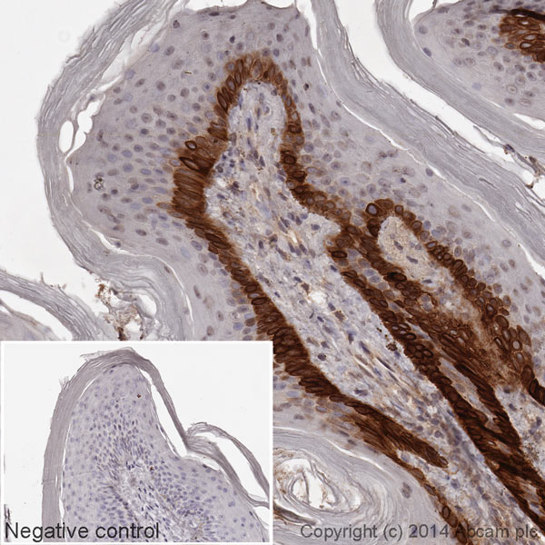 IHC image of Cytokeratin 15 staining in a section of formalin-fixed paraffin-embedded normal human skin tissue*. The section was pre-treated using pressure cooker heat mediated antigen retrieval with sodium citrate buffer (pH6) for 30mins. The section was incubated with ab194067, at a working dilution of 1 in 500 overnight at +4°C. The section was counterstained with haematoxylin and mounted with DPX.The inset negative control image is taken from an identical assay without primary antibody.For other IHC staining systems (automated and non-automated) customers should optimize variable parameters such as antigen retrieval conditions, primary antibody concentration and antibody incubation times.*Tissue obtained from the Human Research Tissue Bank, supported by the NIHR Cambridge Biomedical Research Centre