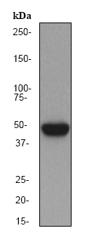 Anti-Cytokeratin 16 antibody [EP1615Y] (ab76416) at 1/10000 dilution + HaCat cell lysate at 10 µgSecondaryHRP labelled goat anti-rabbit at 1/2000 dilution