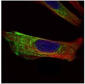 Confocal immunofluorescence analysis of paraformaldehyde fixed HeLa cell labelling Cytokeratin 17 with ab137846 (green) at a 1/500 dilution. Alpha tubulin filaments were labeled with an Alpha tubulin antibody (red) at 1/2500.