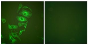 Immunofluorescent analysis of HepG2 cells labeling Cytokeratin 17 with ab195725 at 1/100 dilution. The image on the right shows the negative control using PBS and Rabbit IgG Isotype Control.
