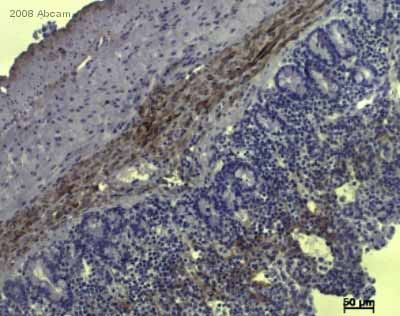 ab6308 staining pig small intestine tissue sections by IHC-P.  Sections were PFA fixed and subjected to heat mediated antigen retrieval in citrate buffer (pH 6) (ab64214) prior to incubating with ab6308, diluted 1/800, for 1 hour at 20°C.  A HRP-conjugated goat anti-mouse antibody was used as the secondary.The use of an antibody diluent replaced a blocking step.See Abreview