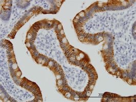Cytokeratin 17 antibody (ab55393) used in immunohistochemistry at 3ug/ml on formalin fixed and paraffin embedded human small Intestine.