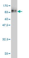 Western blot against tagged recombinant protein immunogen using ab55393 Cytokeratin 17 antibody at 1ug/ml.