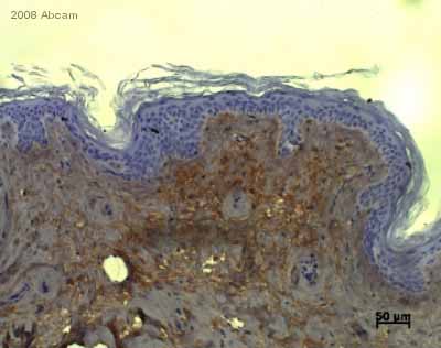 ab6308 staining human skin tissue sections by IHC-P.  Sections were PFA fixed and subjected to heat mediated antigen retrieval in citrate buffer (pH 6) prior to incubating with ab6308, diluted 1/800, for 1 hour at 20°C.  An Alexa Fluor® 488 conjugated goat anti-mouse (ab150113) antibody was used as the secondary.The use of an antibody diluent replaced a blocking step.See Abreview