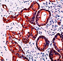 Human skin stained with anti-Cytokeratin 19 antibody (ab15463).