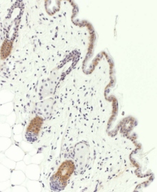 This image shows formalin-fixed mouse skin stained with Cytokeratin 19 antibody (1/50 dilution) after pepsin digestion. 
