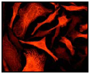Immunofluorescent staining of HeLa cells using ab52907 (1:250).