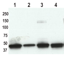 All lanes : Anti-Cytokeratin 19 antibody [A53-B/A2] (ab7754) at 1/1000 dilutionLane 1 : Lung tumour lysate (patient 1)Lane 2 : Lung tumour lysate (patient 2)Lane 3 : Lung tumour lysate (patient 3)Lane 4 : Lung tumour lysate (patient 4)Lysates/proteins at 5 µg per lane.SecondaryGoat anti mouse HRP (H and L) at 1/40000 dilutionPerformed under reducing conditions.Observed band size : 44 kDa (why is the actual band size different from the predicted?)Additional bands at : 150 kDa. We are unsure as to the identity of these extra bands.See Abreview