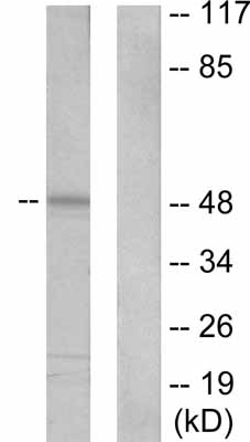 All lanes : Anti-Cytokeratin 20 antibody (ab53120) at 1/300 dilutionLane 1 : HeLa cell extractLane 2 : HeLa cell extract with immunising peptide