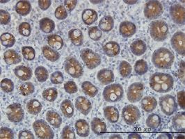 Cytokeratin 4 antibody (ab55392) used in immunohistochemistry at 3ug/ml on formalin fixed and paraffin embedded human small Intestine.