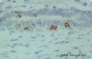 ab24646 at a 1/1500 dilution staining mouse mammary gland tissue sections by IHC (Formalin-fixed paraffin-embedded sections). The antibody was incubated with the tissue for 1 hour following heat mediated antigen retrieval and paraformaldehyde fixation. An HRP polymer conjugated goat antibody was used as the secondary antibody.See Abreview
