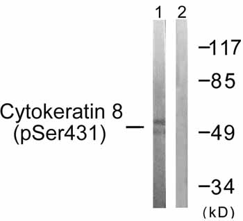 All lanes : Anti-Cytokeratin 8 (phospho S431) antibody (ab59434) at 1/500 dilutionLane 1 : 293 cell extract treated with EGF (200ng/ml, 30 mins)Lane 2 : 293 cell extract treated with EGF (200ng/ml, 30 mins) with phosphopeptide