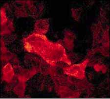 Immunofluorescent staining of A431 cells using anti-Phospho-Keratin 8 (ab32579) diluted 1/250.