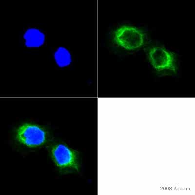 Ab32579 staining cells from a human pancreatic cell line by ICC/IF.  The cells were PFA fixed and permeabilized in 0.1% Triton X-100 prior to blocking in 1% BSA for 30 minutes at 22°C.  Ab32579 was diluted 1/25 and incubated with the sample for 1 hour at 22°C.  An Alexa Fluor® 488 conjugated donkey anti-rabbit antibody was used as the secondary.See Abreview
