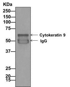 Western blot analysis on immunoprecipitation pellet from HeLa cell lysate labeling Cytokeratin 9, using ab171966 at 1/10 dilution.