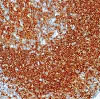 ab756 staining human tonsil by IHC-P.