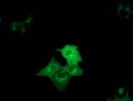 ab123901, at a 1/100 dilution, staining Cytoplasmic dynein 1 light intermediate chain 1 in COS7 cells transiently transfected with pCMV6-ENTRY Cytoplasmic dynein 1 light intermediate chain 1 by Immunofluorescence.