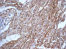 Immunohistochemical analysis of paraffin-embedded Human heart tissue labeling Cytoplasmic dynein 1 light intermediate chain 1 with ab157468 at 1/100 dilution.