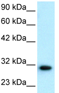 Anti-D Box Binding Protein antibody - BSA and Azide free (ab22824) at 1 µg/ml + HepG2 cell lysateObserved band size : 32 kDa (why is the actual band size different from the predicted?)