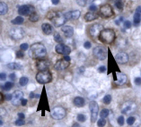 IHC image of DBP at concentrations 4-8ug/ml from paraffin embedded human liver. Arrows indicate hepatocytes with positive labelling.