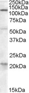 Anti-DAGLA antibody (ab81984) at 0.3 µg/ml + human liver lysate (in RIPA buffer) at 35 µgdeveloped using the ECL technique