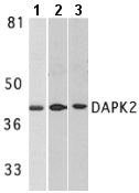 All lanes : Anti-DAP Kinase 2 antibody (ab8404) at 1 µg/mlLane 1 : A431 whole cell lysateLane 2 : Mouse spleen lysateLane 3 : Rat kidney lysateObserved band size : 42 kDa (why is the actual band size different from the predicted?)