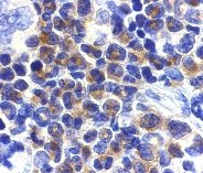 ab8404 at 2µg/ml staining DAP kinase 2 in mouse spleen cells by IHC