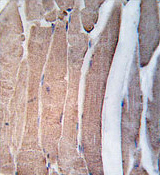 Immunohistochemistry (Formalin/PFA-fixed paraffin-embedded sections) analysis of human skeletal muscle tissue labelling DAP Kinase 2 with ab37995. A peroxidase-conjugated anti-rabbit IgG was used as the secondary antibody, followed by DAB staining.