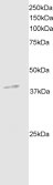 DAPK2 staining (2µg/ml) of Mouse Brain extracts (RIPA buffer, 35µg total protein per lane). Primary incubated for 1 hour. Detected by western blot using chemiluminescence
