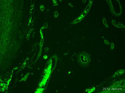 IHC-Fr image of human blood vessels stained with Ab124834 (1/500). The fixed brain section were permeabilise in 0.1% PBS-Triton X for 1h. The sections were incubated with 10% donkey serum for 1 h at 24°C to block non-specific protein-protein interactions. The sections were then incubated with Ab124834 used at 1/500 dilution, overnight at 4°C. The secondary antibody was Alexa Fluor® 488 donkey anti-rabbit used at a 1/1000 dilution for 1h. DAPI was used to stain the cell nuclei (blue) at a concentration of 1.43µM.See Abreview
