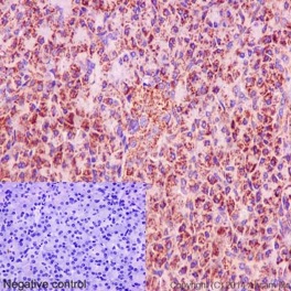 Immunohistochemical analysis of formalin fixed paraffin embedded Human pancreas labeling DAP13 with ab192607 at 1/600 (0.5μg/ml) dilution and prediluted HRP polymer to Rabbit/Mouse IgG as secondary.