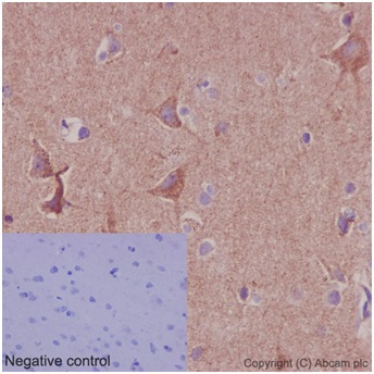 Immunohistochemical analysis of paraffin-embedded Human brain tissue labeling DAP13 with ab192617 at 1/1000 dilution (2μg/ml). A Ready to use HRP Polymer for Rabbit IgG (prediluted) was used as secondary. Counterstain: Hematoxylin.